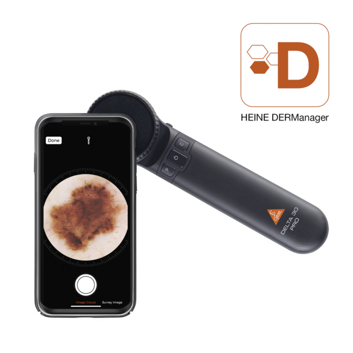 Dermatoskop DELTA 30 PRO - obrazek 4
